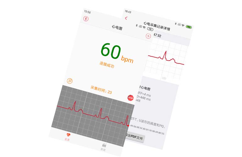 APP集成實(shí)例---心電芯片、心電手環(huán)芯片、可穿戴心電設(shè)備、智能監(jiān)護(hù)儀